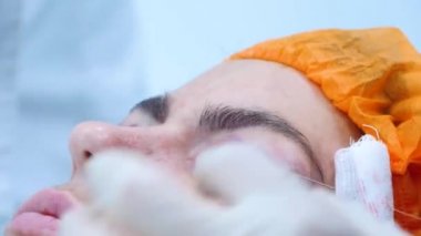 Bir cerrahın yakın çekimi göz kapaklarını diker. Estetik ameliyat. Transkonjonktival blefaroplasti. Göz ameliyatı.