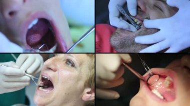 Diş hekimi - hastalar açık ağız ağız muayenesi sırasında