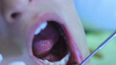 Diş hekimi - hastalar açık ağız ağız muayenesi sırasında