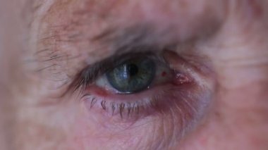 Yaşlı kadının göz