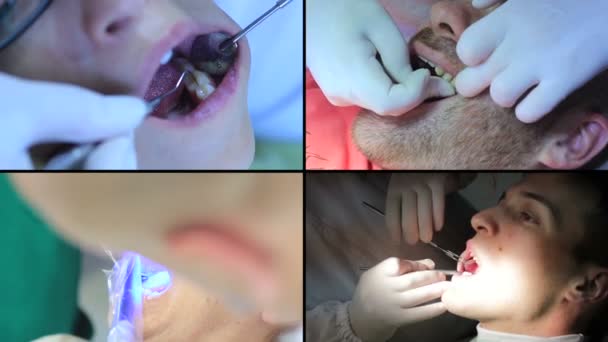 Dentista trabalhando em uma cirurgia dentária real — Vídeo de Stock