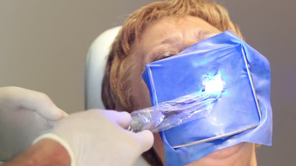 Dentysta, za pomocą światła ultrafioletowego Uv — Wideo stockowe