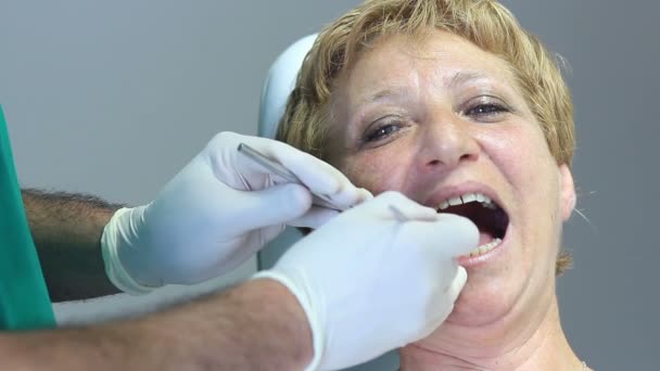 Dentista - Pacientes boca aberta durante o check-up oral — Vídeo de Stock