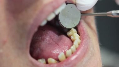 sözlü sınav yapıyor diş hekimi