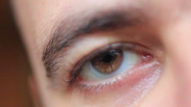 Adamın gözünü detay görüntüleri