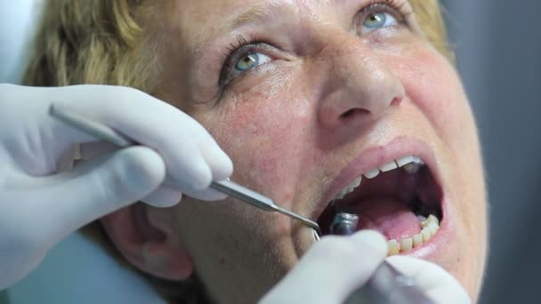 歯科医師 - 患者のクローズ アップ口腔診査中に口を開く — ストック動画