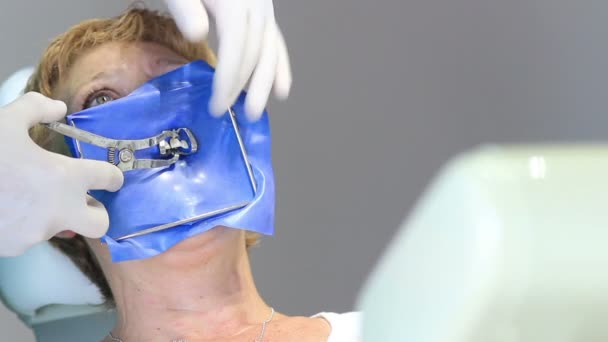 歯科医師 - 患者口腔診査中に口を開く — ストック動画