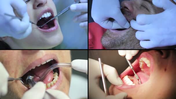 Tandläkare - patienter öppen mun under muntliga checkup — Stockvideo