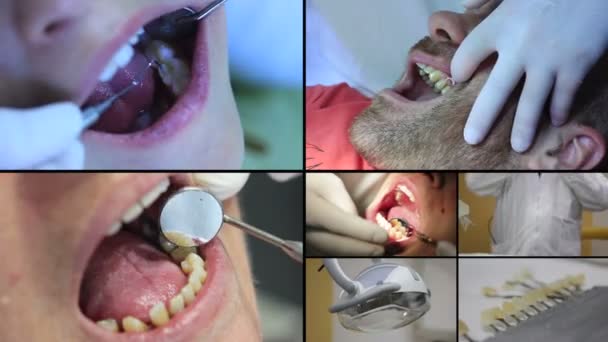 Dentista - Pazienti a bocca aperta durante il controllo orale — Video Stock