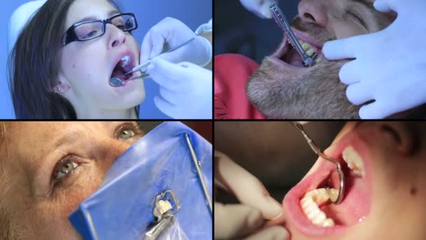 Equipo de dentista: los dientes femeninos están siendo revisados por el médico — Vídeos de Stock