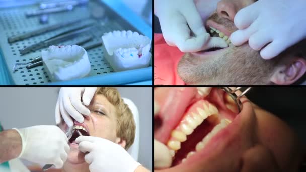 Dentista trabalhando em uma cirurgia dentária real — Vídeo de Stock