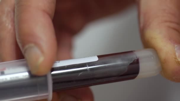 Dessin réel procédure sanguine 