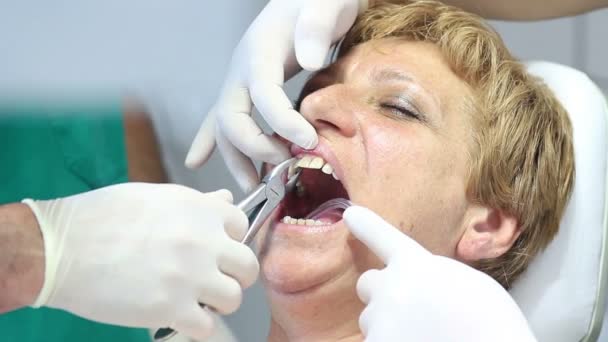 Equipamento odontológico - Dentes femininos sendo verificados pelo médico — Vídeo de Stock