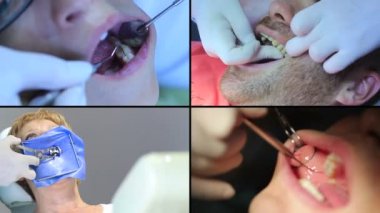 Diş hekimi - hastalar açık ağız ağız muayenesi sırasında