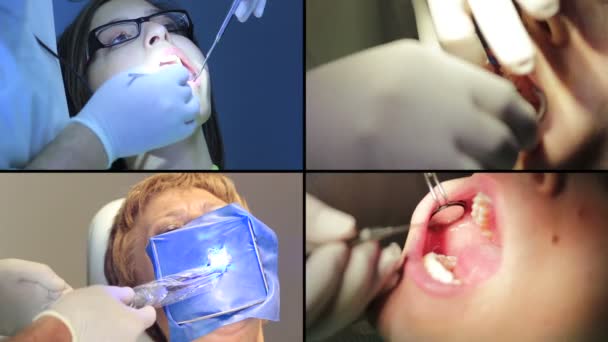 Dentista - Pacientes boca aberta durante o check-up oral — Vídeo de Stock