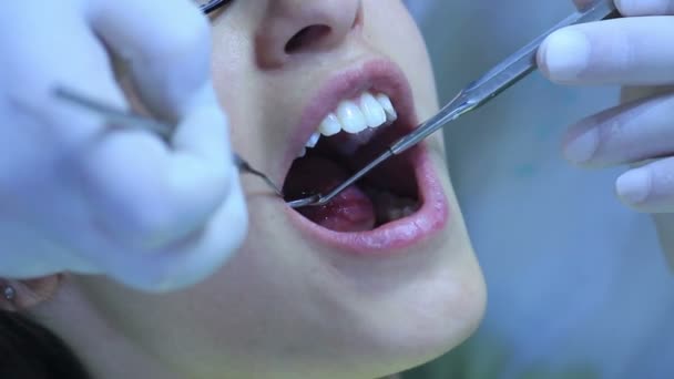 Стоматолог - крупным планом пациент (молодая девушка) открыть рот во время перорального обследования — стоковое видео