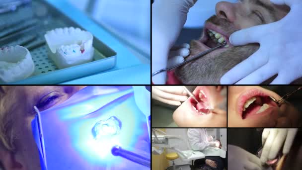 Tandarts apparatuur - tandheelkundige behandeling met ultraviolet licht apparatuur — Stockvideo