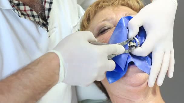 Equipamento odontológico - cura dentária com equipamento de luz ultravioleta — Vídeo de Stock