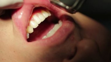 Diş hekimi - hasta Close-up açık ağız ağız muayenesi sırasında