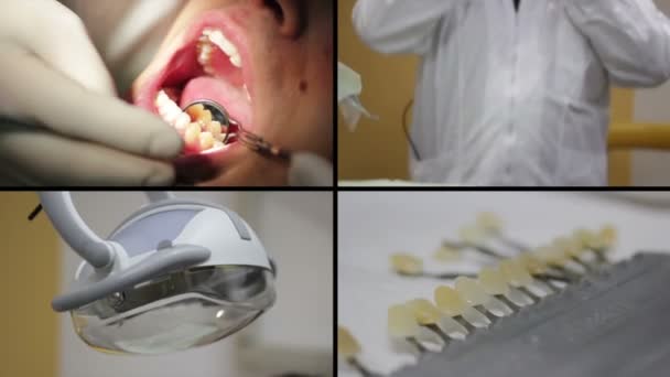 Close-up da boca aberta do doente durante o check-up oral — Vídeo de Stock