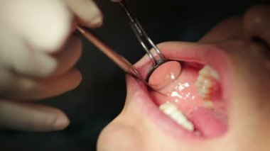Diş hekimi - hasta Close-up açık ağız ağız muayenesi sırasında