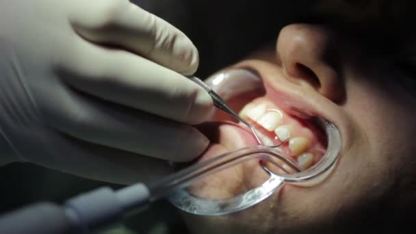 Dentiste - Gros plan sur la bouche ouverte du patient lors du bilan buccal — Video