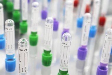 İnsan sağlığı muayenesi için kan örnekleri hastanelerde ya da tıbbi araştırma merkezlerinde kullanılır..