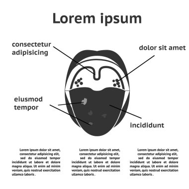 Boğaz ve oral kavite hastalıkları