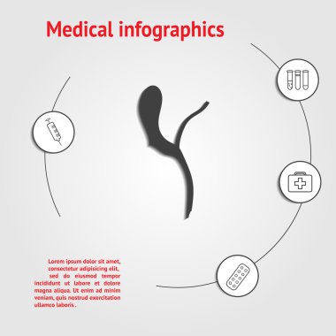 Safra kesesi kanalı bir insan. Tıbbi Infographic