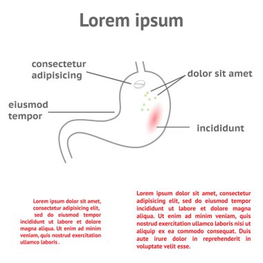 mide ağrısı tedavisi
