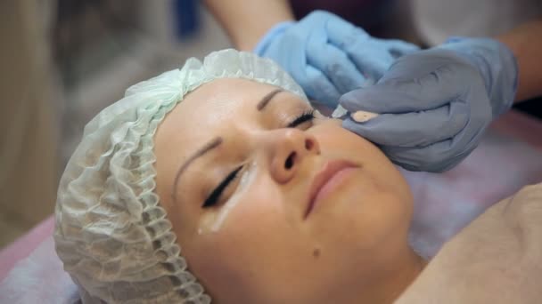 Mesoterapia trattamento della pelle facciale — Video Stock
