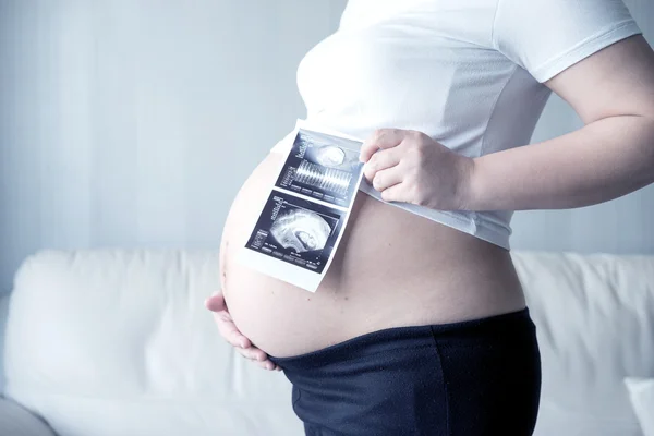Mujer Embarazada Con Imagen Ecografía — Foto de Stock