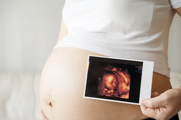 Ultrason tarama resim ile hamile kadın — Stok fotoğraf