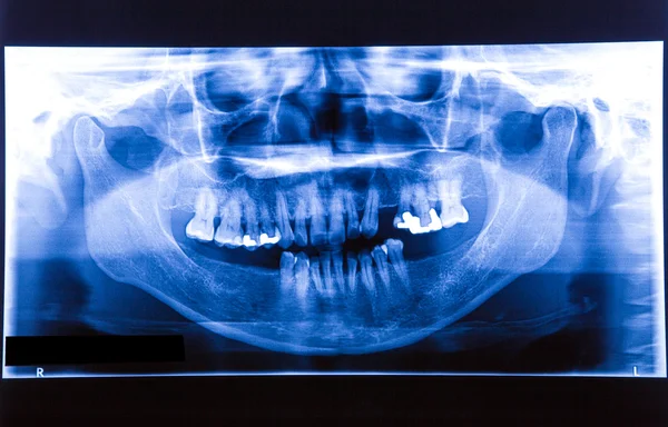 Filme de raio-X humano no hospital — Fotografia de Stock