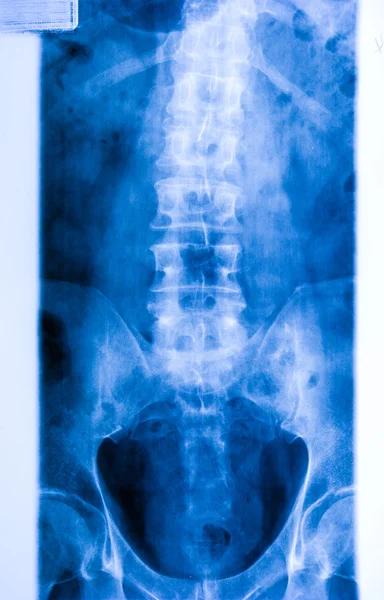 Ankel fot & knä gemensamma mänskliga foto röntgenfilm — Stockfoto