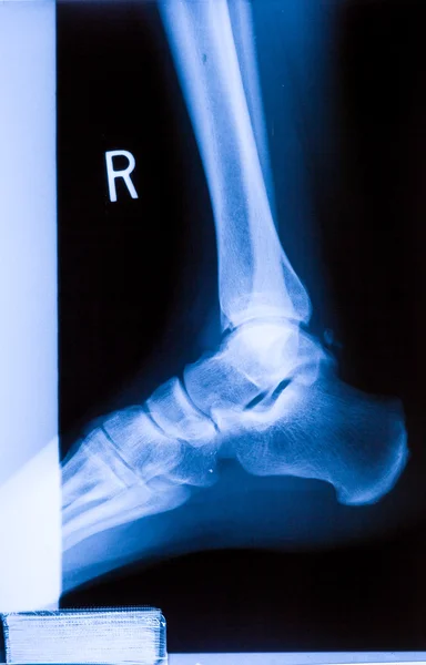 Kotník nohy & koleno společný X-ray lidské fotografický film — Stock fotografie