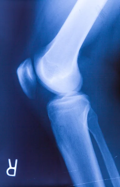 Tobillo pies y rodilla articulación rayos X película de fotos humanas — Foto de Stock