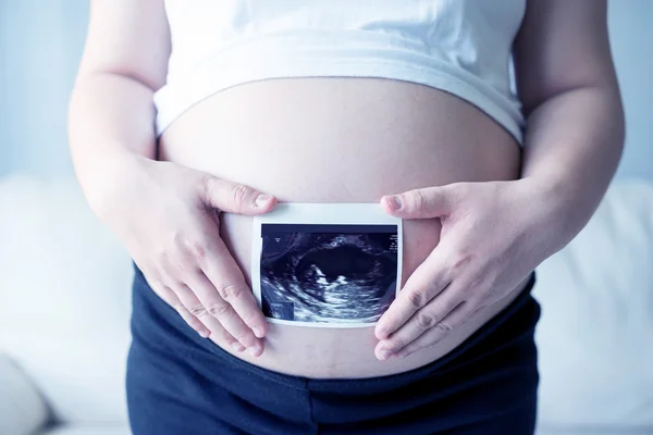 Pregnant Woman Ultrasound Scan Picture — Stock Photo, Image