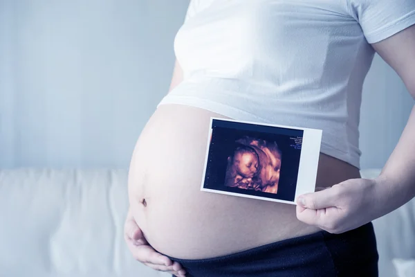 Mujer Embarazada Con Imagen Ecografía —  Fotos de Stock
