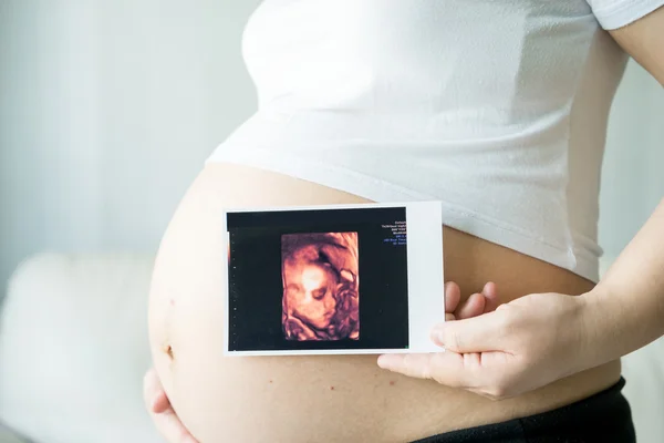 Gravid Kvinna Med Ultraljud Scan Bilder — Stockfoto
