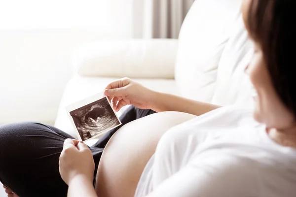 Mulher Grávida Com Imagem Ultra Sonográfica — Fotografia de Stock