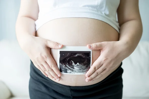 Pregnant woman with ultrasound scan picture — Stock Photo, Image