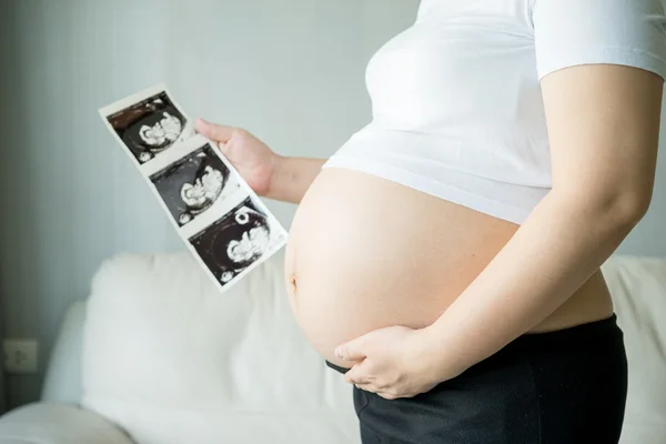 Pregnant woman with ultrasound scan picture — Stock Photo, Image