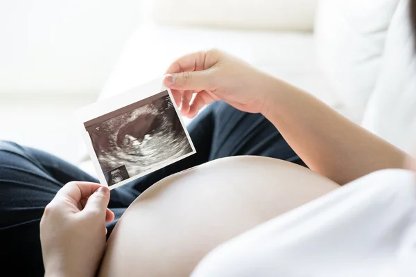Mujer embarazada con imagen de ecografía —  Fotos de Stock