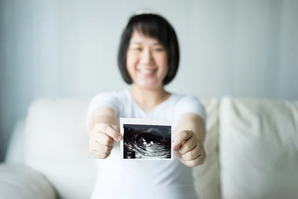 Έγκυος γυναίκα με υπερηχογραφική εικόνα σάρωσης — Φωτογραφία Αρχείου
