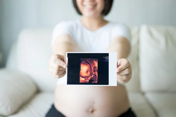 Pregnant woman with ultrasound scan picture — Stock Photo, Image