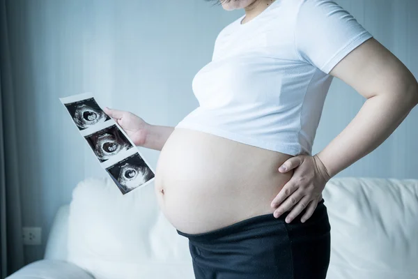 Беременная женщина с ультразвуковым сканированием — стоковое фото
