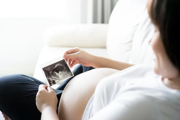 Gravid kvinna med ultraljud scan-bilder — Stockfoto