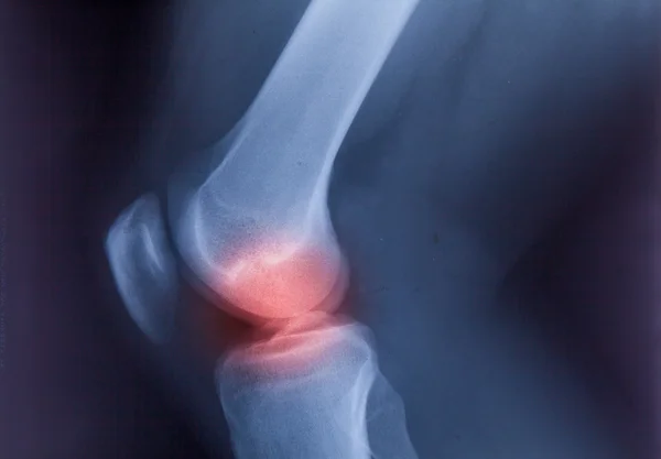 Kotník nohy & koleno společný X-ray lidské Foto fil — Stock fotografie