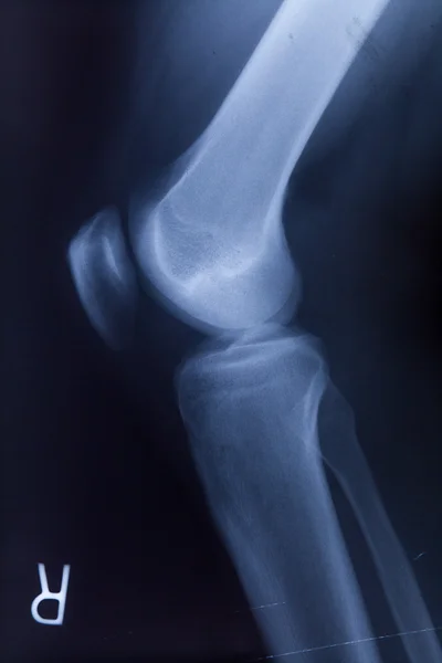 Kotník nohy & koleno společný X-ray lidské Foto fil — Stock fotografie